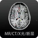 Ӱ�����ͼ��(ҽѧӰ��ѧϰƽ̨)v4.6.2 �ٷ�����